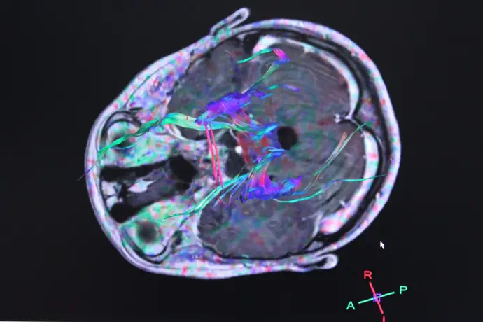 Imagen de archivo de actividad del cerebro