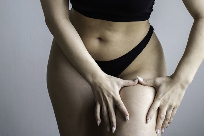 Archivo - Young caucasian woman squeezing her leg with her hands to check for cellulite - Body acceptance concept - Body positive and cellulite on the thighs