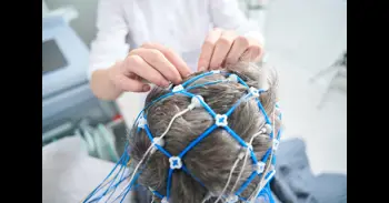 La estimulación magnética cerebral abre una nueva vía contra la demencia: el 76% de los pacientes se estabiliza