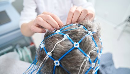 La estimulación magnética cerebral abre una nueva vía contra la demencia: el 76% de los pacientes se estabiliza