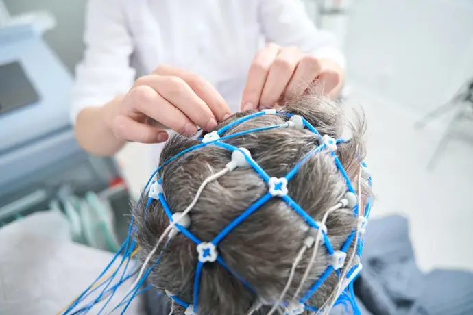 Estimulacion Magnética Cerebral