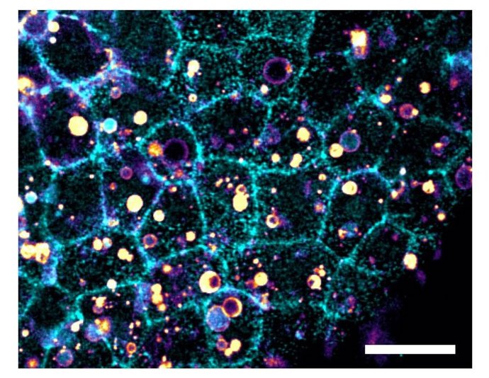 Tejido con partículas ingeridas.