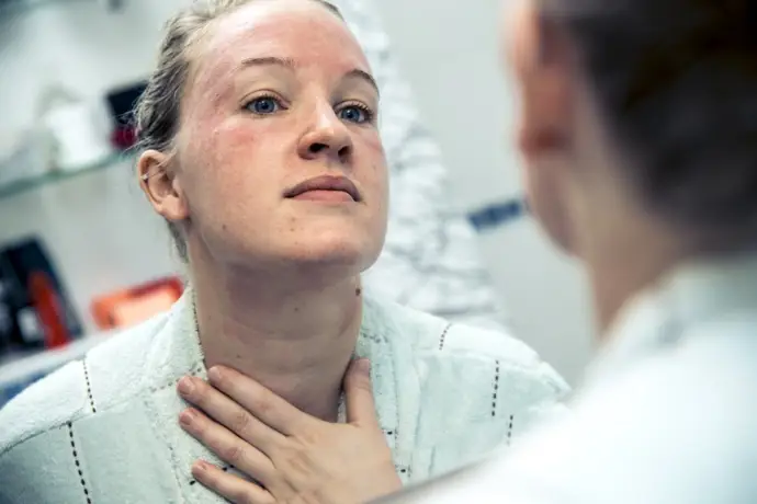 Eccema, piel, dermatitis