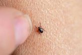 Foto: Descubren cómo detectar la enfermedad de Lyme antes de que los síntomas aparezcan