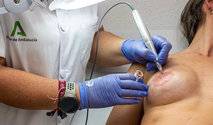 Una profesional realiza una micropigmentación de areola mamaria a una paciente.
