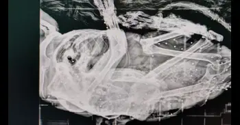 Hallan en Polanco un gato con más de 50 perdigones en su cuerpo