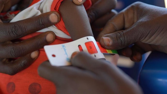 Archivo - Un niño en un centro de nutrición apoyado por el Fondo de Naciones Unidas para la Infancia (UNICEF) en la ciudad de Tawila, situada en el estado de Darfur Norte, en Sudán (archivo)