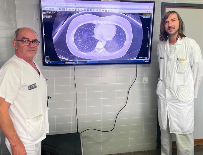 El Hospital Sant Joan d'Alacant desarrolla una IA que predice el tratamiento del asma grave y lee los TAC de tórax