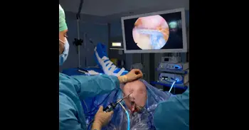 El Hospital de Úbeda incorpora una técnica quirúrgica para el tratamiento de roturas del manguito rotador