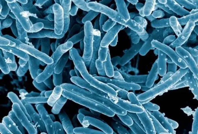 Imagen de microscopio de la bacteria Mycobacterium tuberculosis