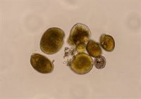 Detectan por primera vez en aguas del Mediterráneo peninsular una microalga productora de ciguatoxinas