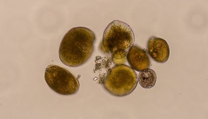 Detectan por primera vez en aguas del Mediterráneo peninsular una microalga productora de ciguatoxinas