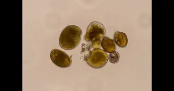 Detectan por primera vez en aguas del Mediterráneo peninsular una microalga productora de ciguatoxinas