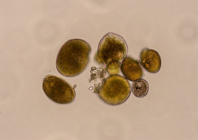 Imagem de 'Gambierdiscus australes' em microscópio óptico invertido