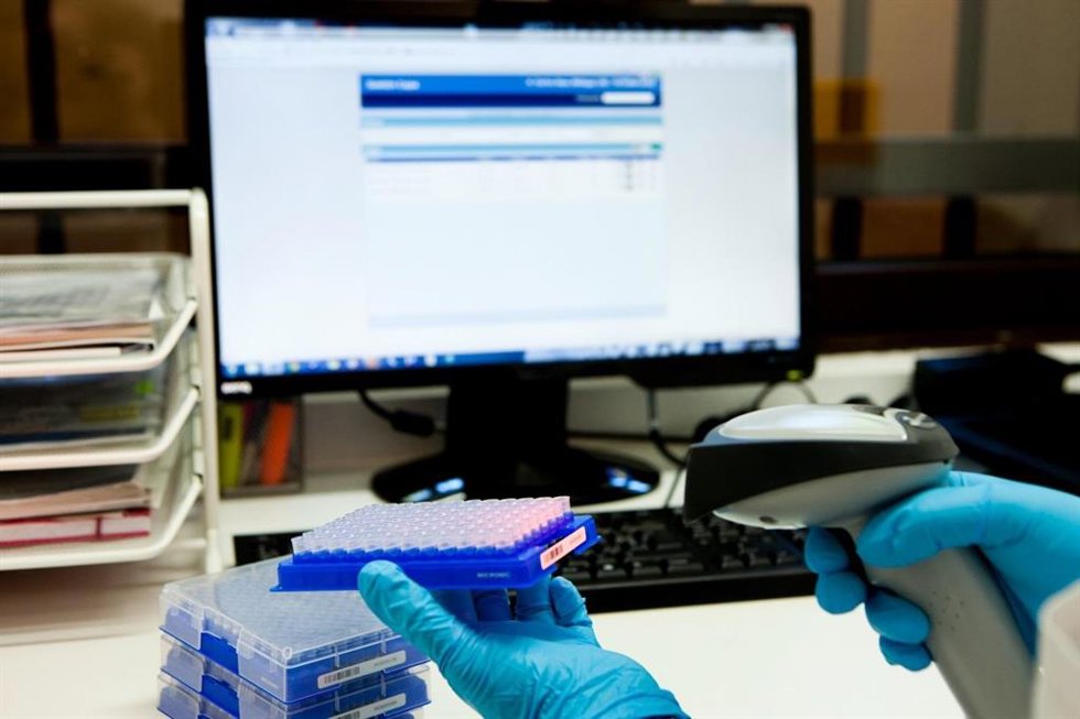 Imagen de pruebas en proyecto de investigación sobre Alzheimer.