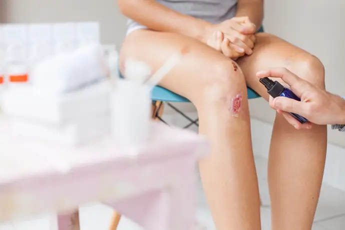 Archivo - Costra, herida