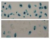 Foto: Descubren que un compuesto derivado de la anémona del mar Caribe podría mejorar el tratamiento contra el cáncer