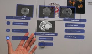 Ivace+i Innovación respalda la plataforma de realidad aumentanda para asistir a los equipos de neurocirugíava