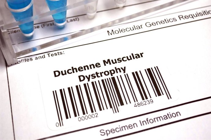 Archivo - Arquivo - Distrofia muscular de Duchenne.