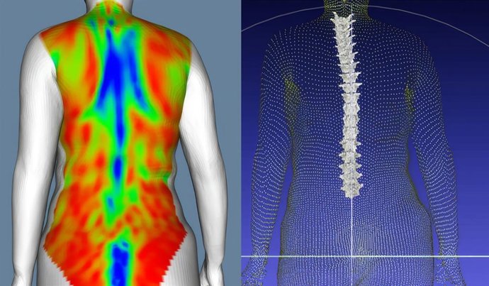 El IBV utiliza escaneo corporal dinámico para desarrollar nuevas metodologías para el estudio de las deformidades de la columna vertebral