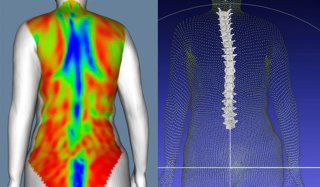 El IBV utiliza escaneo corporal dinámico para desarrollar nuevas metodologías para el estudio de las deformidades de la columna vertebral