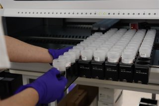 Procesamiento de las muestras