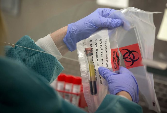 Archivo - May 11, 2017 - St. Paul, MN, USA - United States - Annette Leduc, a medical laboratory technician for the Minnesota Health Department processes tubes with saliva from patients to test for measles, Thursday, May 11, 2017 at the MHD laboratories i