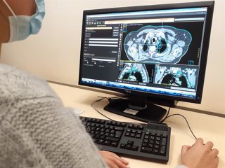 Una oncóloga observa una imagen tomada por SBRT H como foto de recurso.