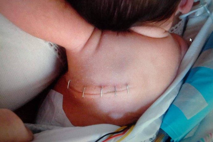 ASFACUME alerta sobre las dificultades de las familias beneficiarias de la prestación CUME