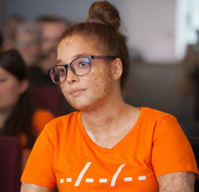 Imagen de una persona con EICR.