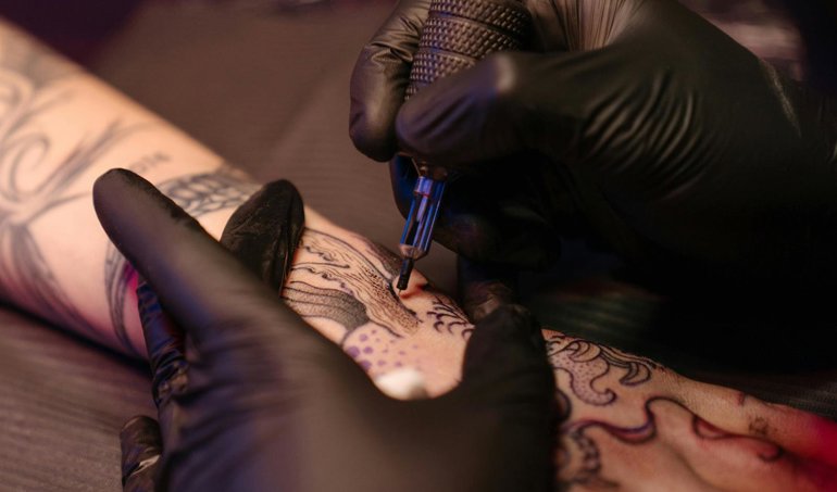 Estética