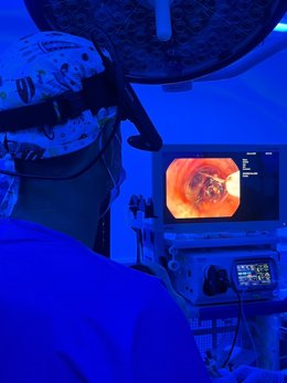 Archivo - Un médico con una  técnica pionera para tratar el cáncer de pulmón