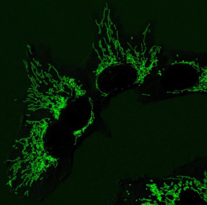 Imagen de microscopía de fluorescencia de las mitocondrias en células humanas sanas, que ayudan a producir los componentes básicos del ADN.