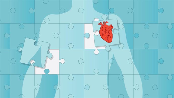 Archivo - Trasplante de corazón.