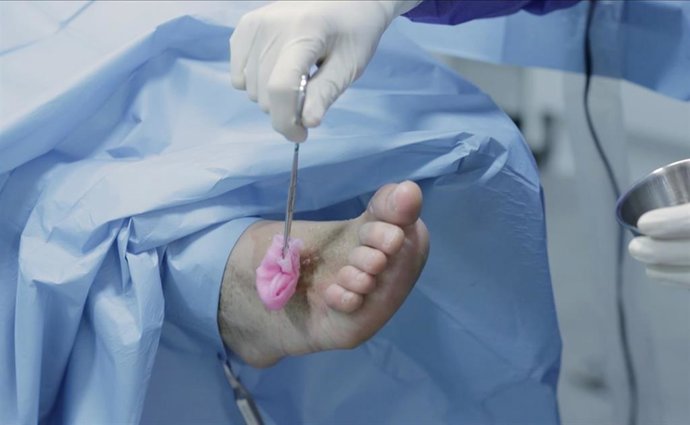 Archivo - La lista de pacientes quirúrgicos aumenta un 20% en Baleares