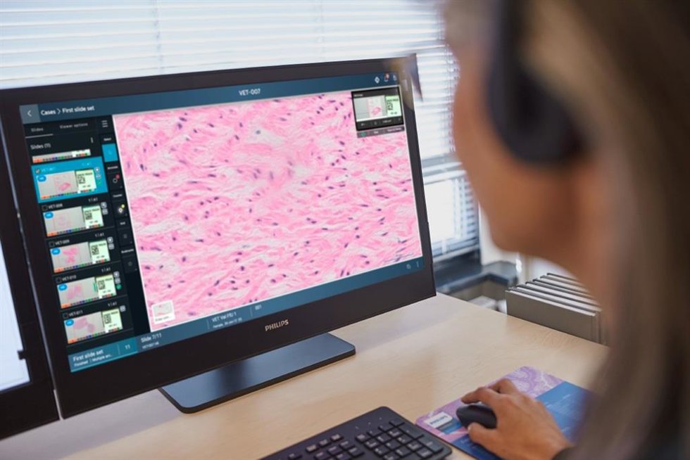 El SERIS inicia la digitalización del Servicio de Anatomía Patológica de los hospitales riojanos por 1,3 millones