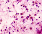 Foto: Macrófagos que recuerdan infecciones: cómo “borrar” su memoria podría abrir nuevas vías contra enfermedades autoinmunes