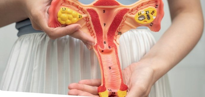 El 14 de marzo se celebra el Día Mundial de la Endometriosis.