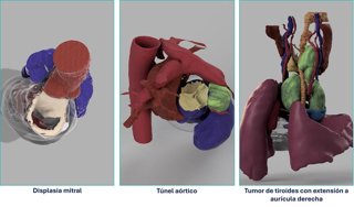 Imagen de recurso de varios ejemplos de modelos.