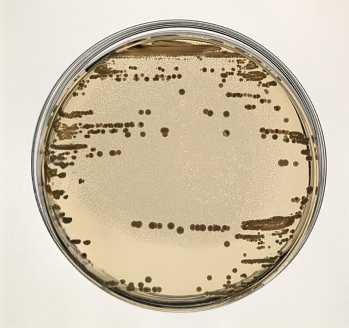 Imagen de placas de cultivo con cepas clínicas de 'Klebsiella pneumoniae'.
