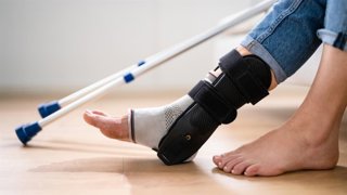 Esguince de tobillo.