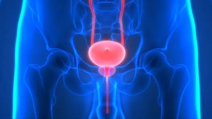 Archivo - Prostate