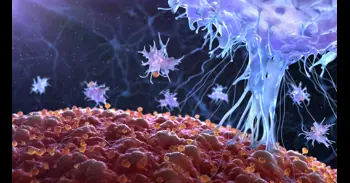 Desarrollan nanopartículas que reprograman desde dentro las defensas para atacar células del lupus y cáncer de la sangre