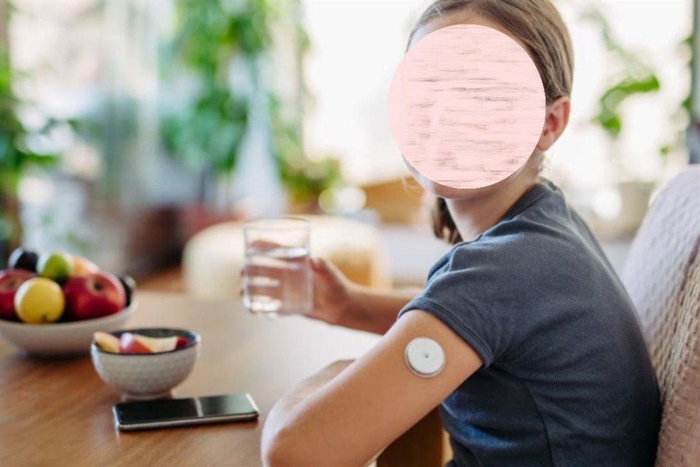 Una adolescente con diabetes, con un dispositivo en el brazo para la medición de azúcar en su cuerpo.
