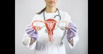 El ayuno intermitente, un aliado para la regulación hormonal en síndrome de ovario poliquístico