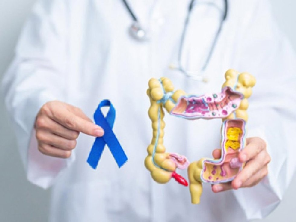 Día Mundial del Cáncer Colorrectal