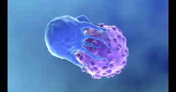 La terapia CAR-T logra la remisión de tres enfermedades autoinmunes en una paciente con mal pronóstico