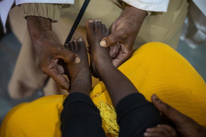 Archivo - Un niño en un programa terapéutico del Fondo de Naciones Unidas para la Infancia (UNICEF) en el centro de salud Marjan al Amal en el estado de Gezira (archivo)