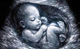 Experto recuerda que "la ecografía de la semana 36 es clave para prevenir complicaciones graves en el embarazo"