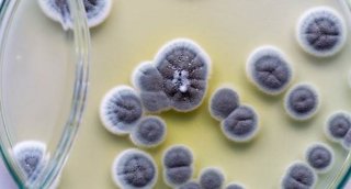 Archivo - Penicillium, hongos ascomicetos de gran importancia en el entorno natural así como en la producción de alimentos. /